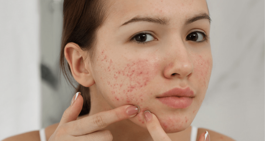 hệ thống nước kém chất lượng